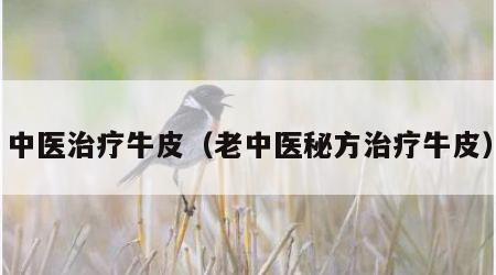 中医治疗牛皮（老中医秘方治疗牛皮）