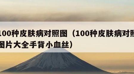100种皮肤病对照图（100种皮肤病对照图片大全手背小血丝）