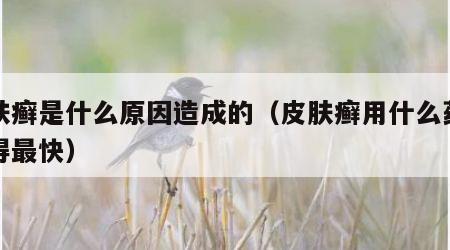 皮肤癣是什么原因造成的（皮肤癣用什么药膏好得最快）