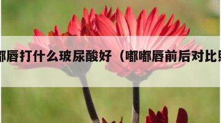 嘟嘟唇打什么玻尿酸好（嘟嘟唇前后对比照片）