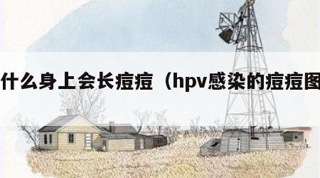 为什么身上会长痘痘（hpv感染的痘痘图片）