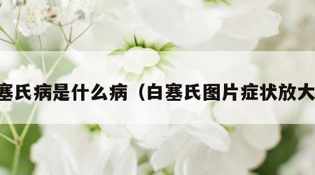 白塞氏病是什么病（白塞氏图片症状放大图）