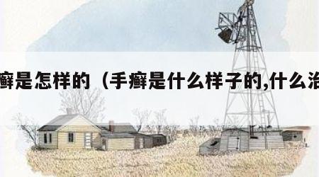 手癣是怎样的（手癣是什么样子的,什么治疗）
