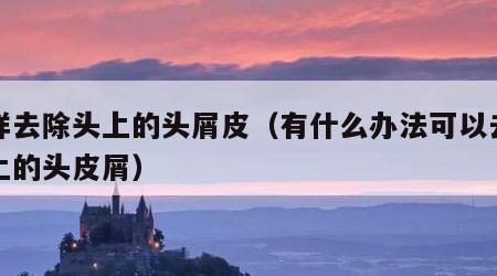 怎样去除头上的头屑皮（有什么办法可以去除头上的头皮屑）